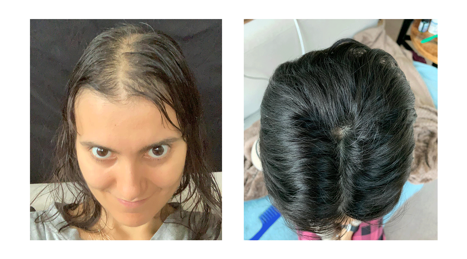 Marcella's AMAZING results after using the More Hair Naturally 9 + the Hair and Scalp Synergy for 6 months!