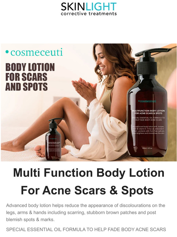 SKINLIGHT New! Body Lotion For Acne Scars & Dark Spots Milled