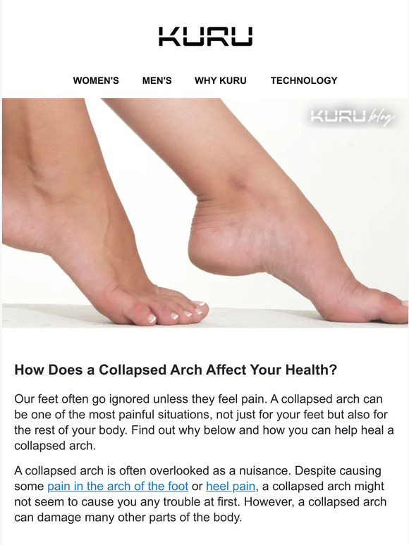 KURU Footwear How Does A Collapsed Arch Affect Your Health? Milled