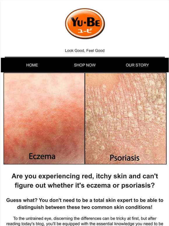 Yu Be Eczema Vs Psoriasis Whats The Difference 🤔 Milled 0345