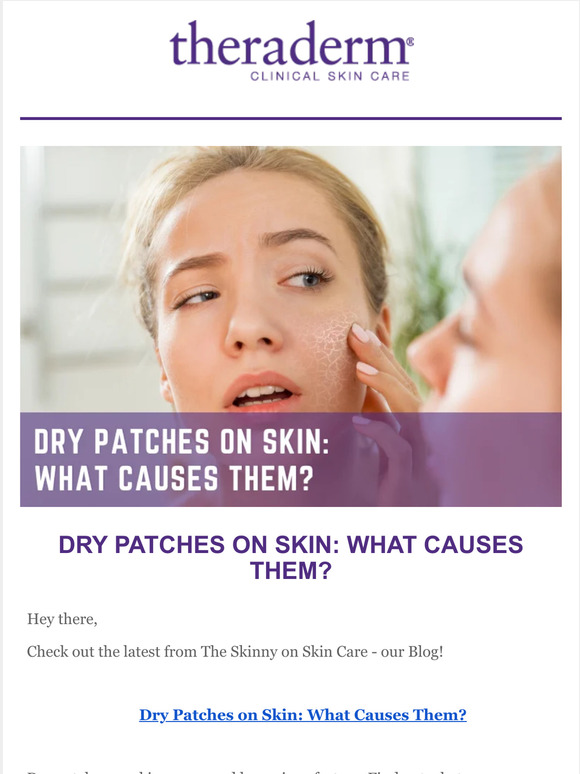 Therapon Skin Health What Causes Dry Patches On Skin Find Out Here Milled 7890