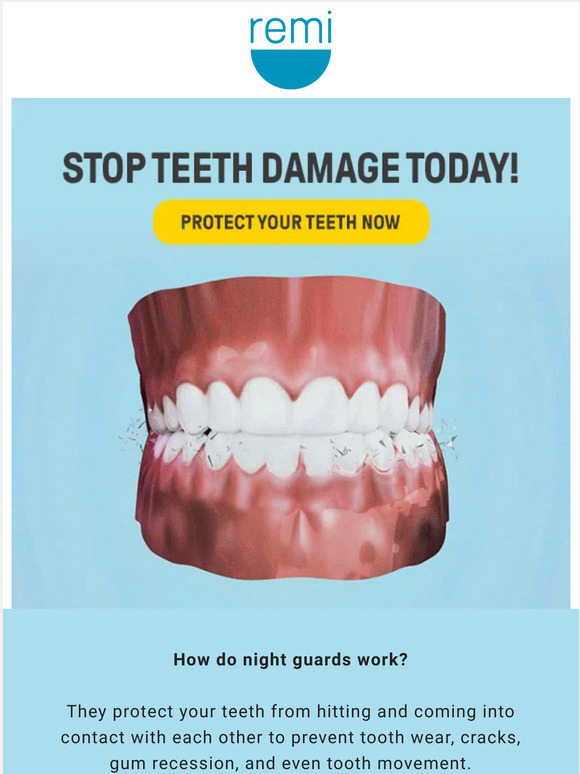 Remi How does a night guard work? Milled