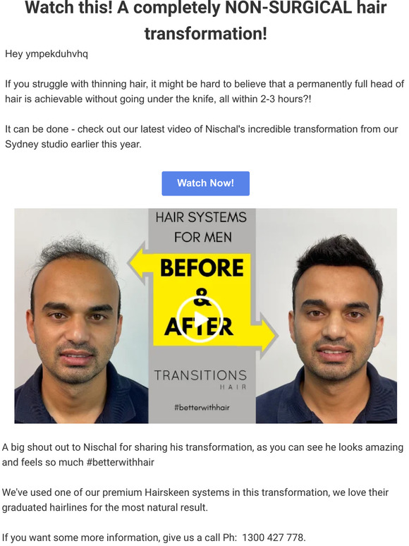 Watch this! 17 Seconds to Thicker Hair - Before & After Hair Transformation