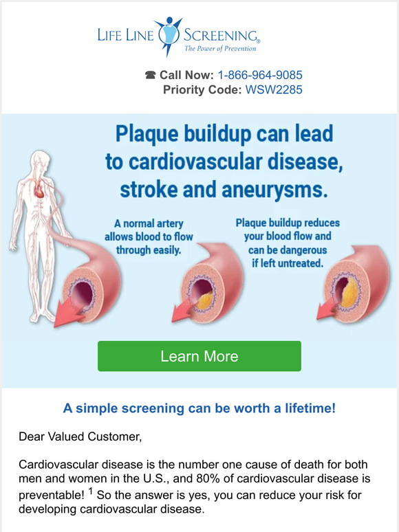 Can you reduce your risk of developing cardiovascular disease?