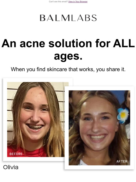 Will ClearBalm work on teenage skin? 🤔
