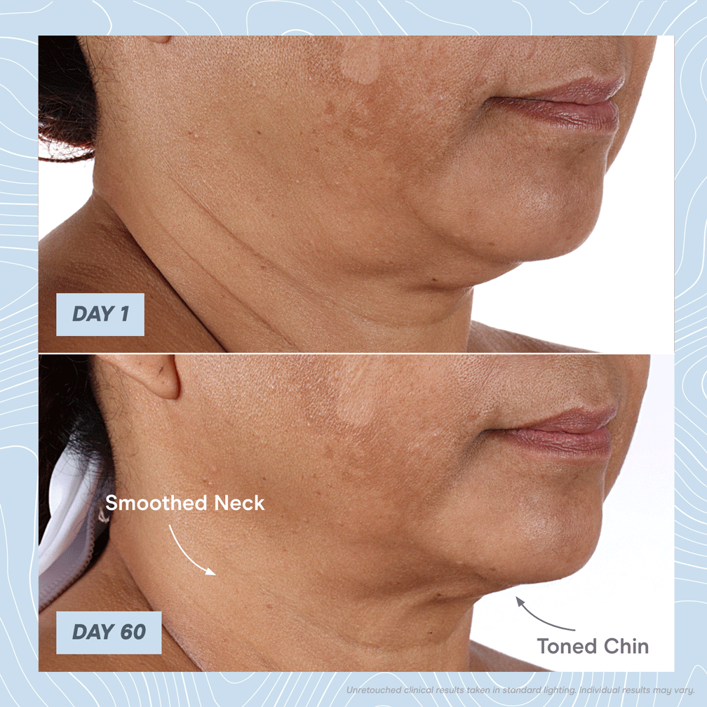 NuFace Depuff Jowls & Contour Cheeks in Minutes Milled