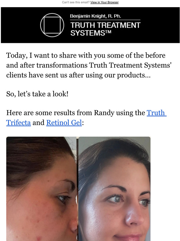 Truth Treatments Before and after skin transformations Milled