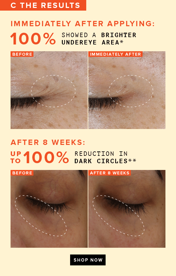 Farmacy Beauty Send your eye bags packing 💼 Milled