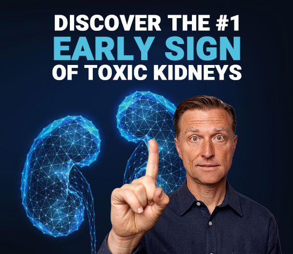 Dr Berg: Watch Out For This Early Sign Of Toxic Kidneys! | Milled