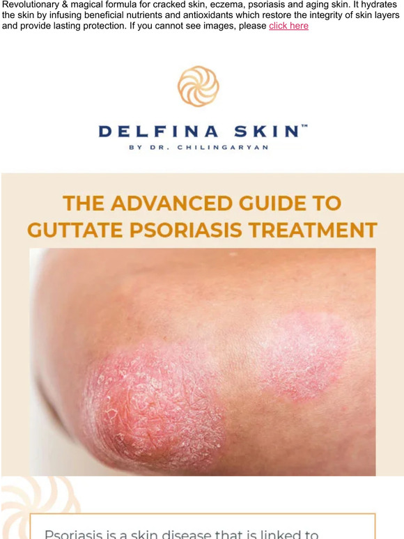 The advanced guide to guttate psoriasis treatment