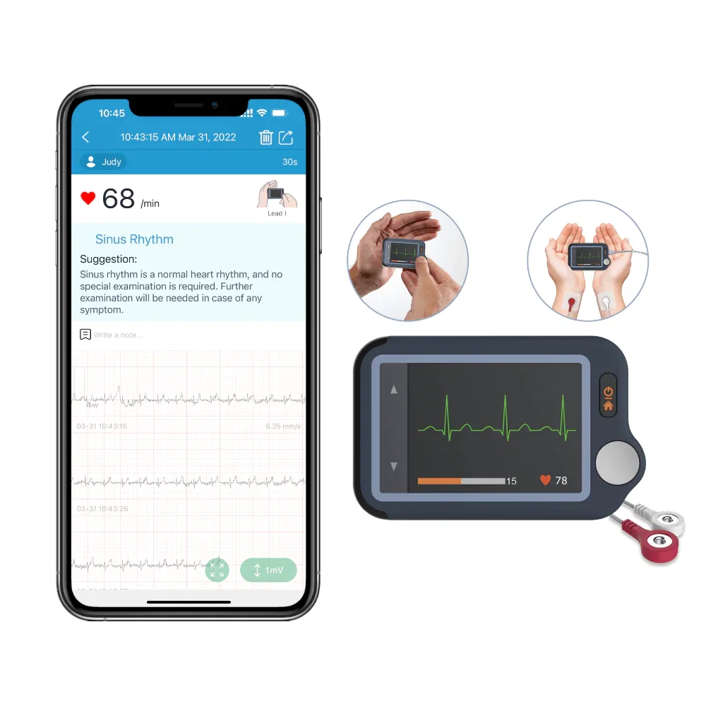 Personal ECG Monitor