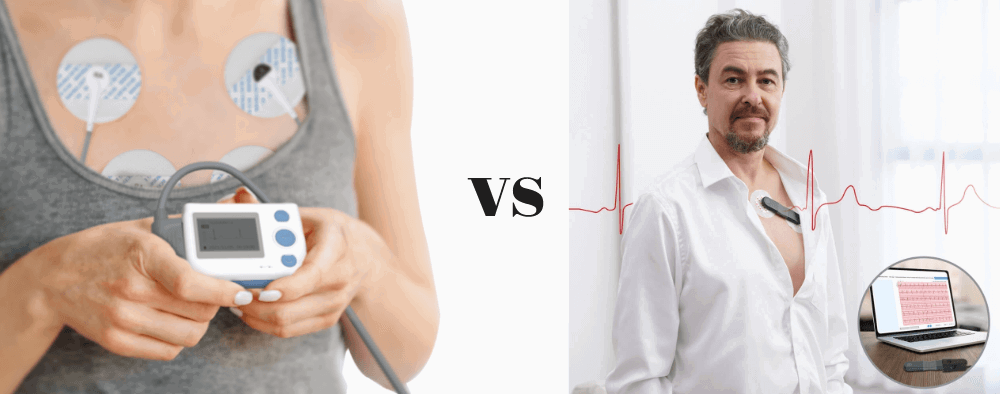12-Lead Holter VS ECG Recorder