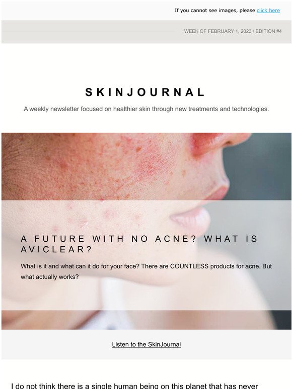 A future with no acne? What is AVICLEAR?