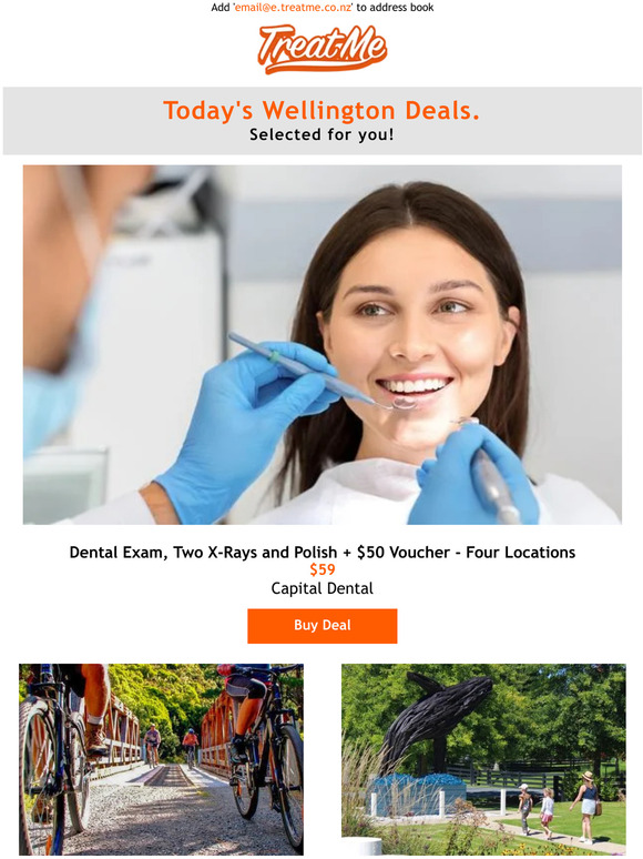 TreatMe NZ Dental Exam, Two XRays and Polish + 50 Voucher Four