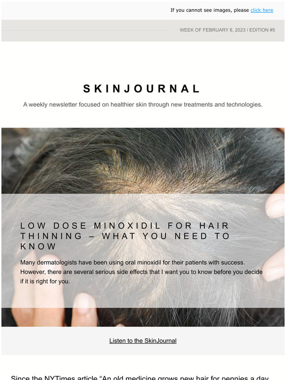 Low dose MINOXIDIL for hair thinning - what you need to know