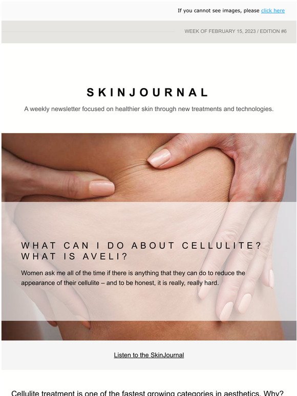 Cellulite - What can I do about it? What is AVELI?