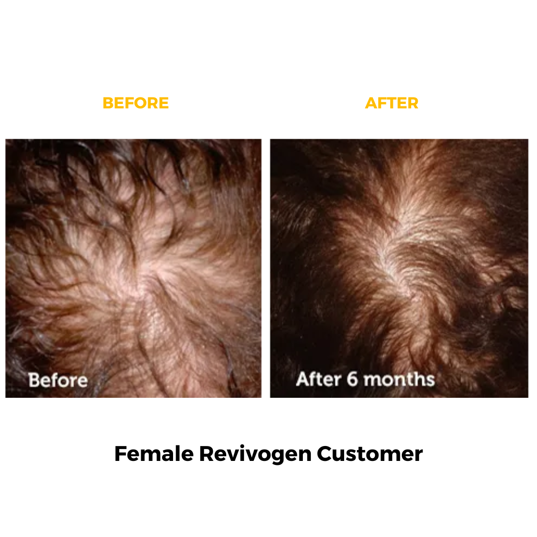 Female Revivogen customer with thinning hair