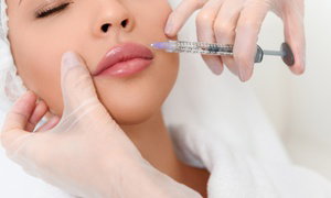 Up to 34% Off Juvéderm Ultra XC Injections at Pure Medical Spa