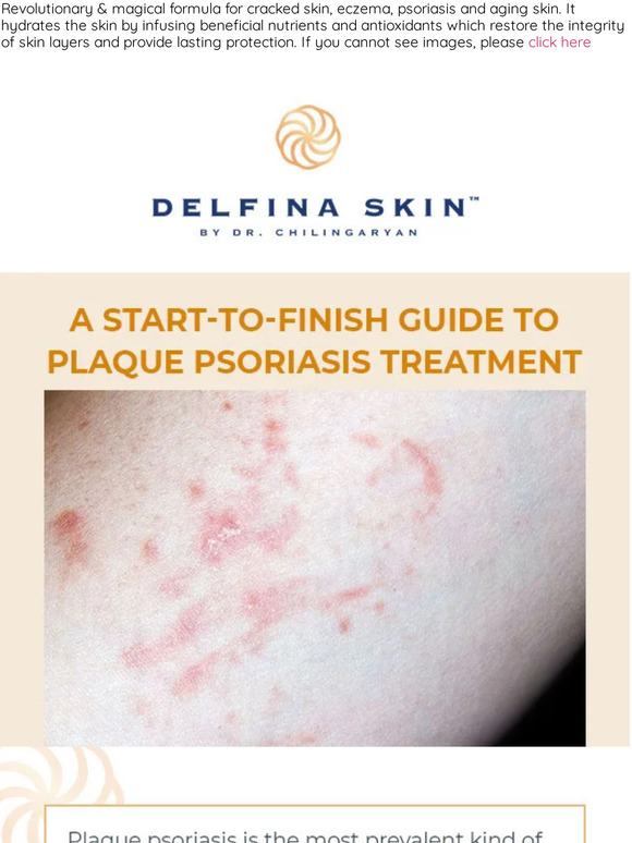 A start-to-finish guide to plaque psoriasis treatment ✨