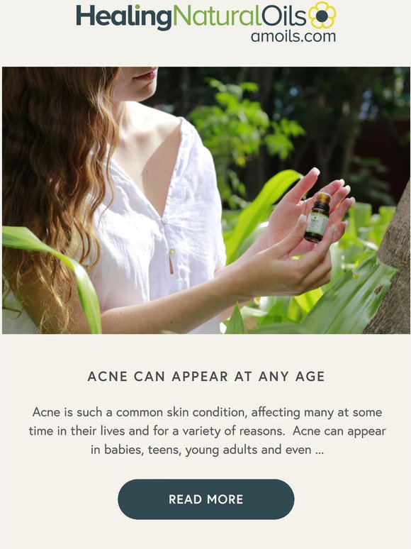 Acne can appear at any age
