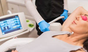 Up to 85% Off Three Laser-Hair Removal Sessions at LightRx