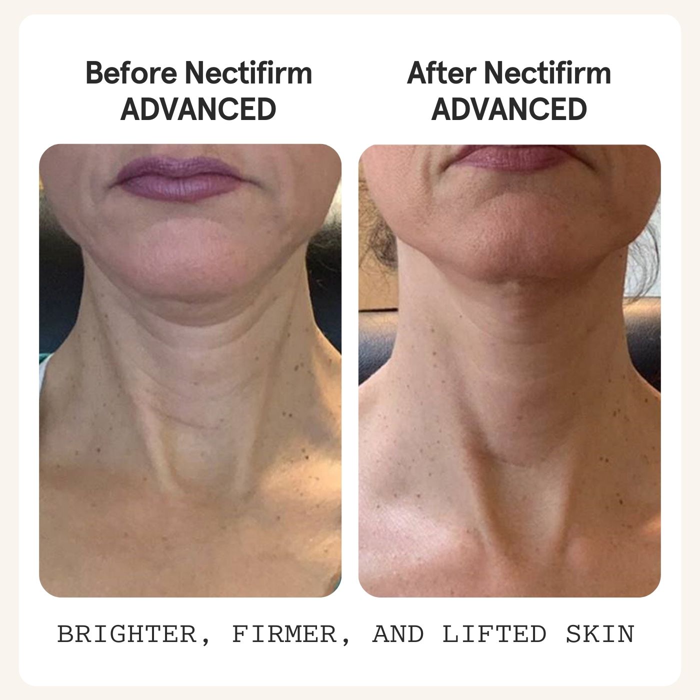 Revision Nectifirm ADVANCED
