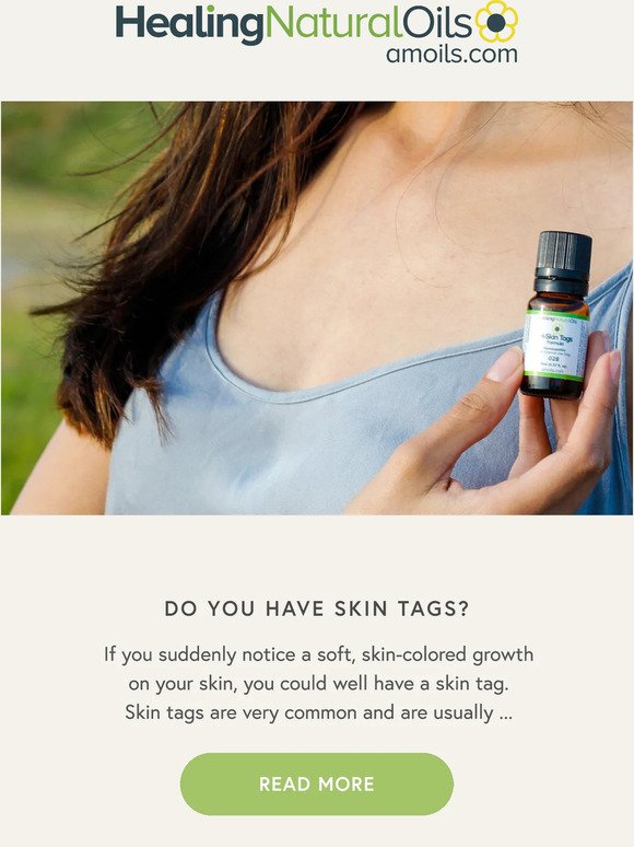 Do You Have Skin Tags?