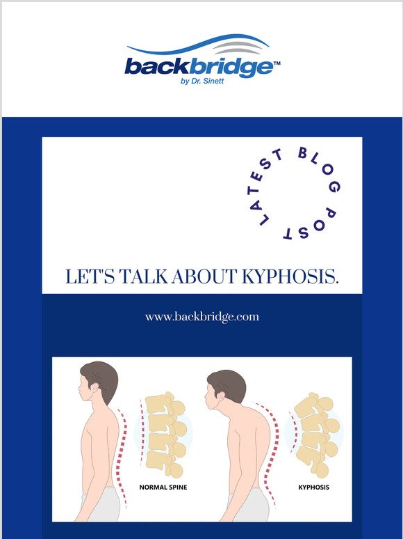 LET'S TALK ABOUT KYPHOSIS.