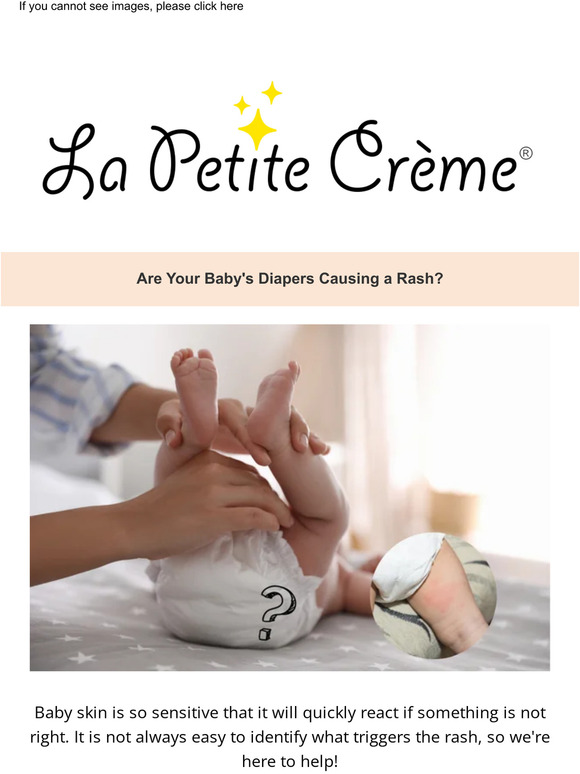 ✨ Are Your Baby's Diapers Causing a Rash? ✨
