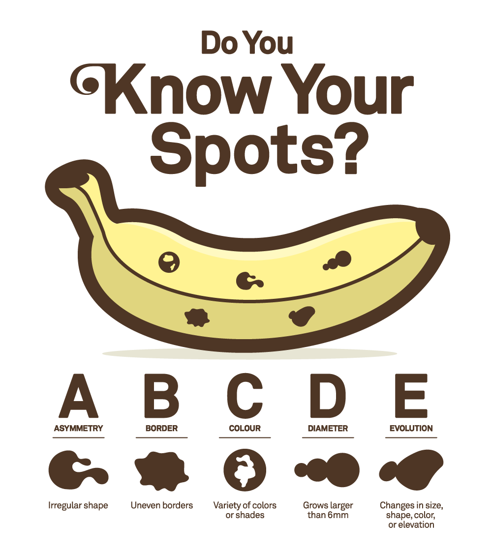 Skin Spot Guide Sun Bum: Know Your Spots | Milled