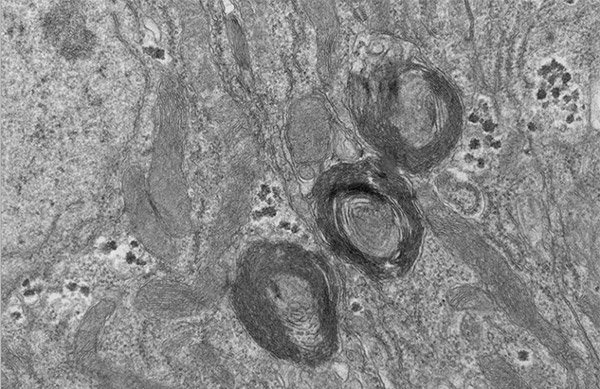 A black and white microscopic image of three PXo bodies in a mature enterocyte of the fly midgut epithelium