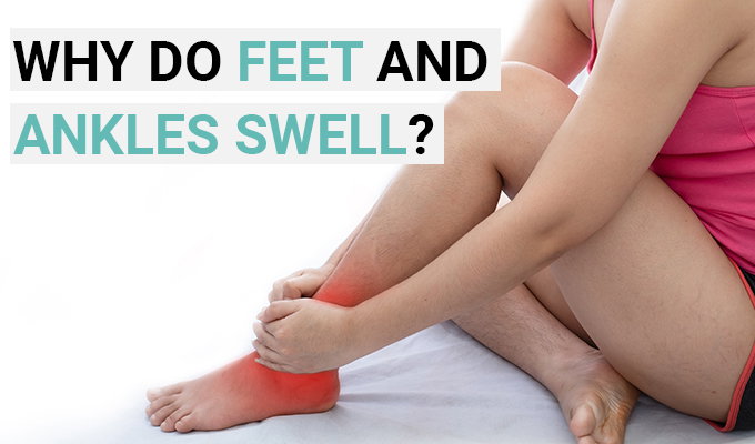 Apex Foot: The Causes of Swollen Ankles and Feet 🦶 | Milled