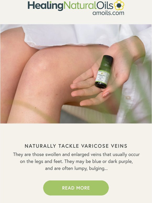 Naturally Tackle Varicose Veins