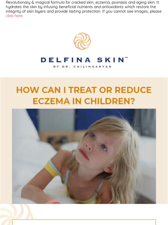 How to treat or reduce eczema in children?