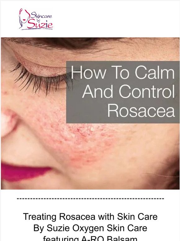 Treating Rosacea with Skin Care By Suzie Oxygen Skin Care featuring  A-RO Balsam
