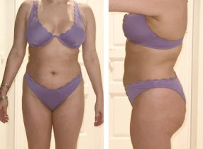 Lipo360