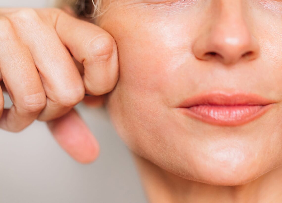 How to get rid of jowls