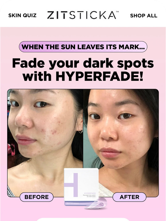 ☀️ When the sun leaves you with dark spots...