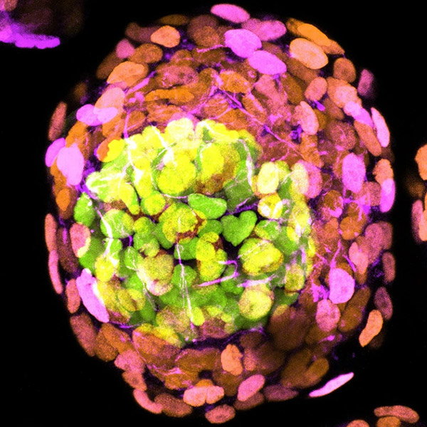 This four-day-old embryoid on a black background looks like a colourful fireworks explosion: a scatter of green dots surrounded by orange, purple and pink blobs.