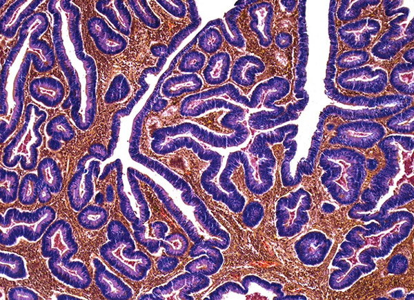 An abstract forest of purple-stained cellular structures grows in this microscopy image.