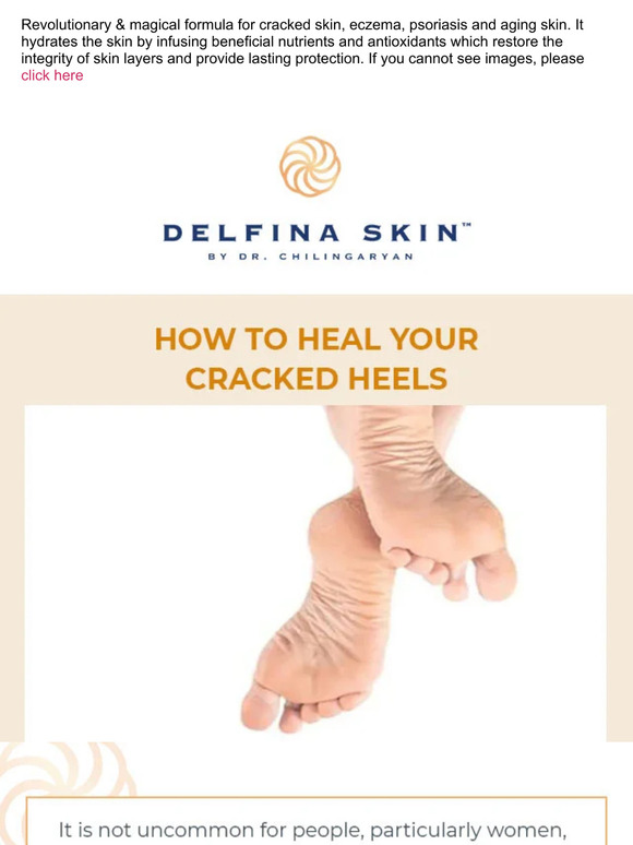 Unlock the Secret to Healing Cracked Heels 🤩