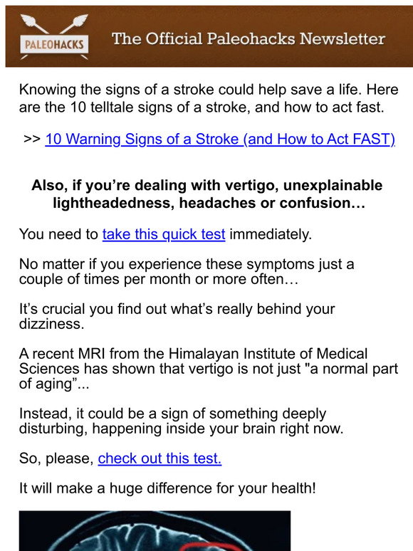 paleorecipeteam 10 Warning Signs of a Stroke (and How to Act FAST