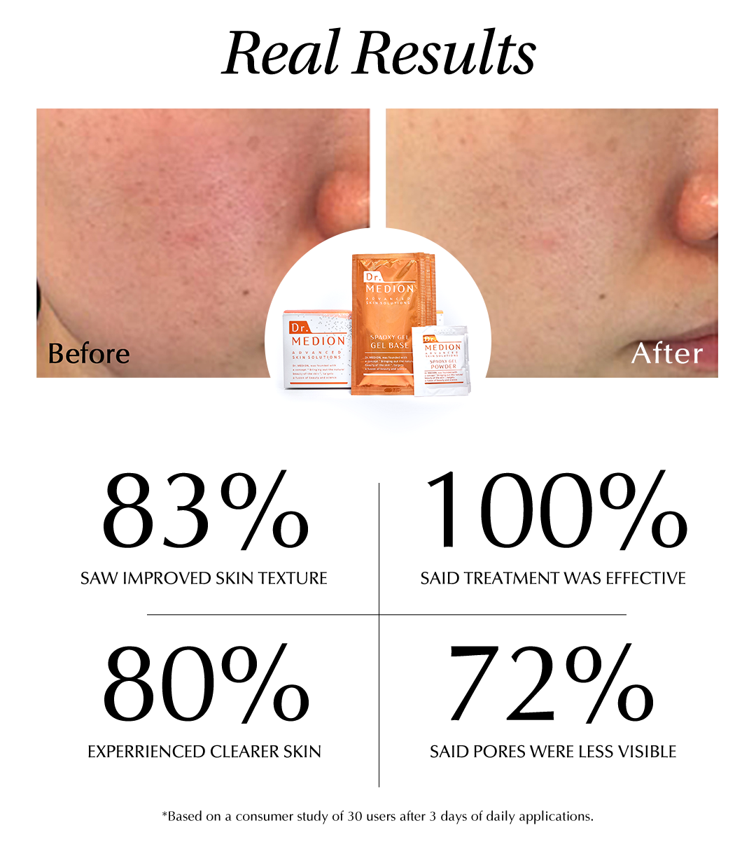 Real Results | Dr. MEDION Spaoxy Gel (3 Masks)