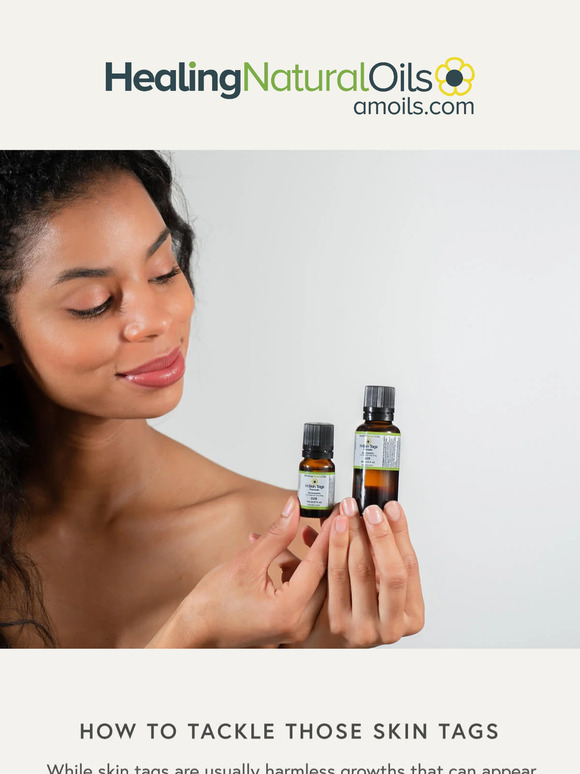 How to Tackle Those Skin Tags