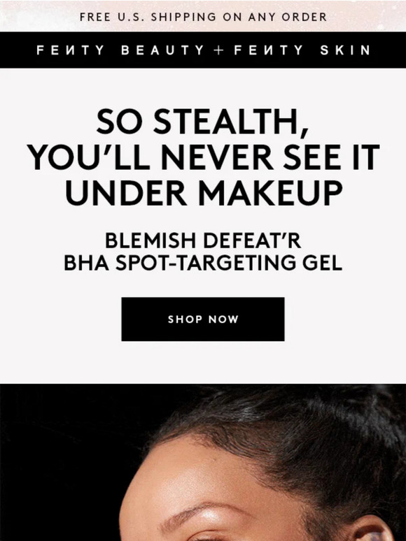 Dealin’ w/ blemishes? We got u covered