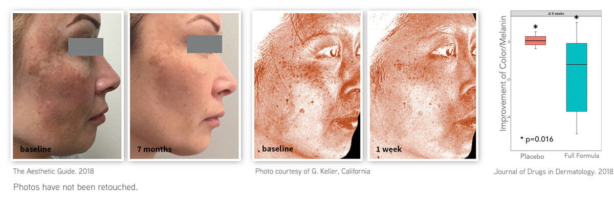 Damage Reducer DefenAge: The Ultimate Sun Damage Reducer | Age-Repair Defensins ® | Milled