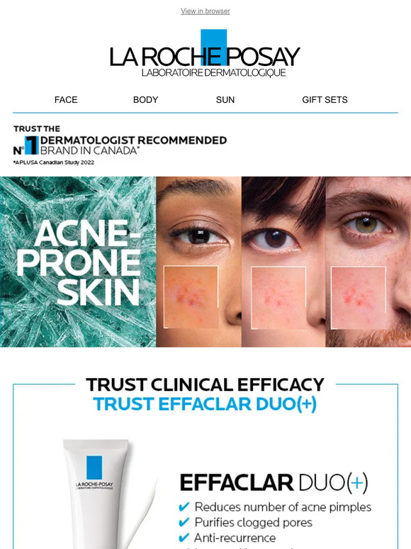 Care For Your Acne-Prone Skin