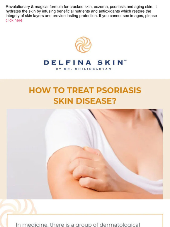 How To Treat Psoriasis Skin Disease?