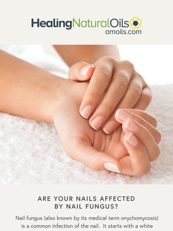 Are Your Nails Affected by Nail Fungus?