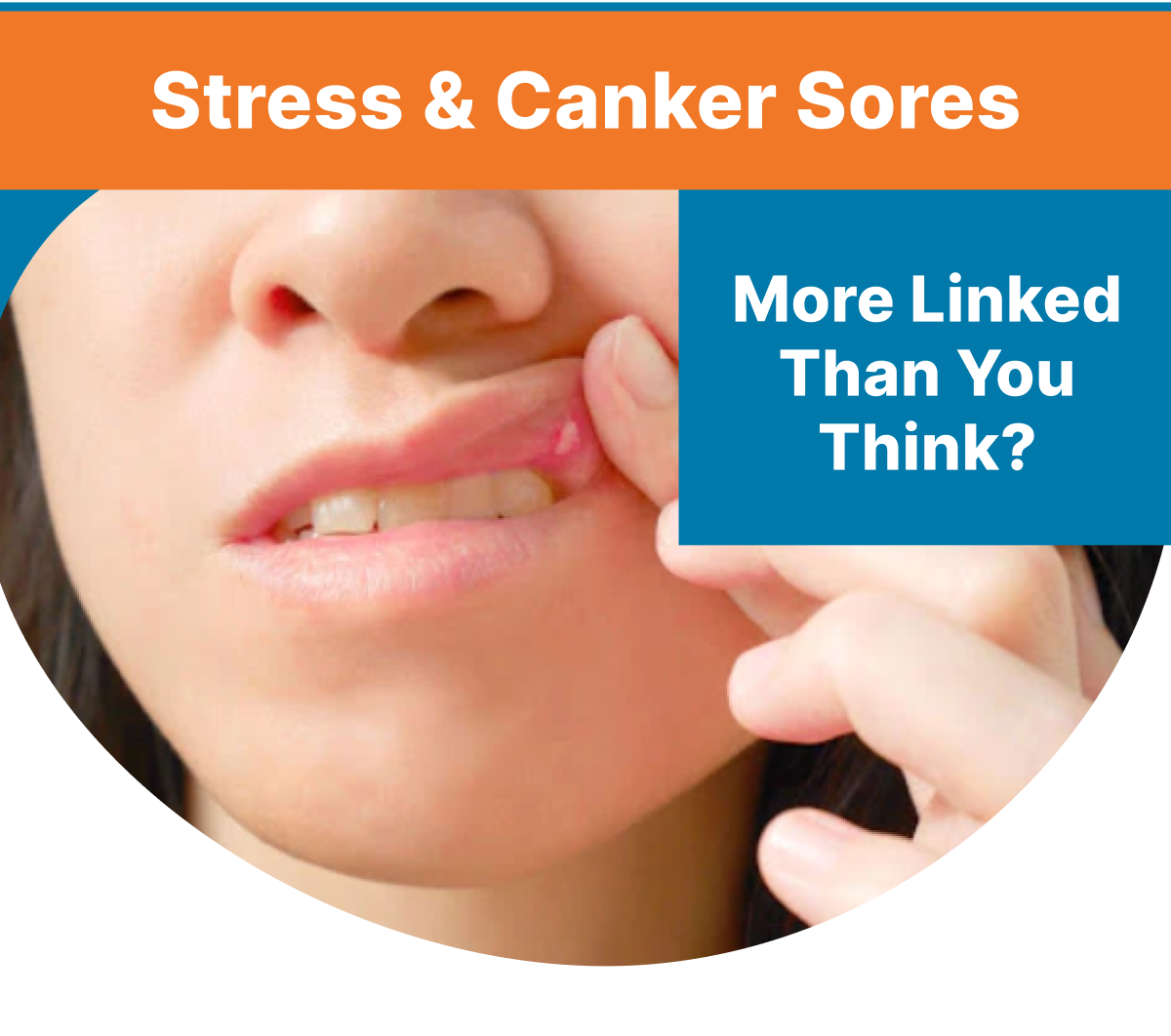 JS Dental Lab: Canker Sores Giving You A Tough Time? 😫 | Milled